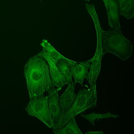 U2OS 骨肉瘤细胞，GFP 染色，荧光观察方式